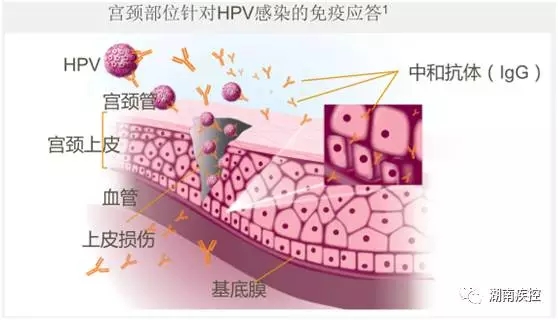 HPV的感染和清除过程